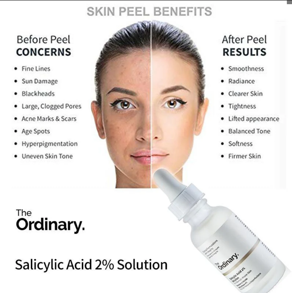 Salicylic Acid 2% Solution 30 ml (Original)